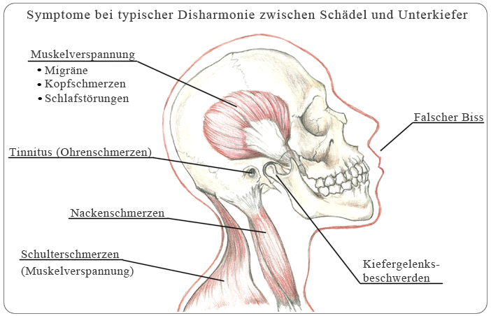 Symptome typischer Disharmonie